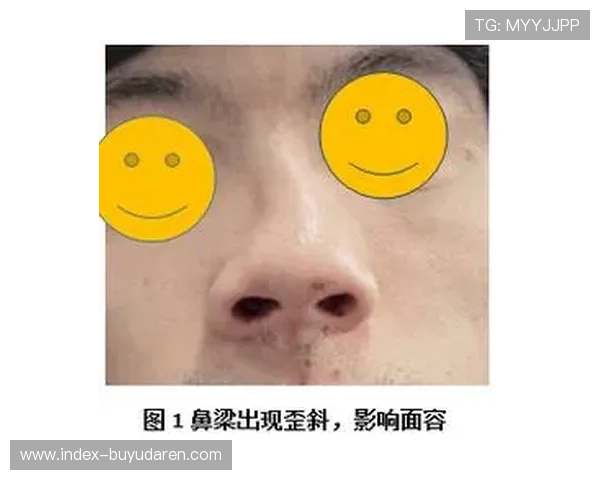 穆罕默德惨败伤情报告:眼眶骨折、鼻梁断裂与唇部撕裂